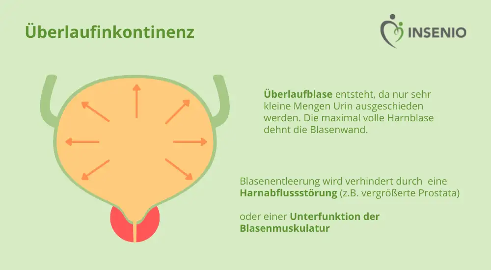 Infografik Überlaufinkontinenz