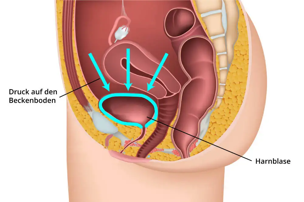 belastungsinkontinenz-ratgeber Schaubild